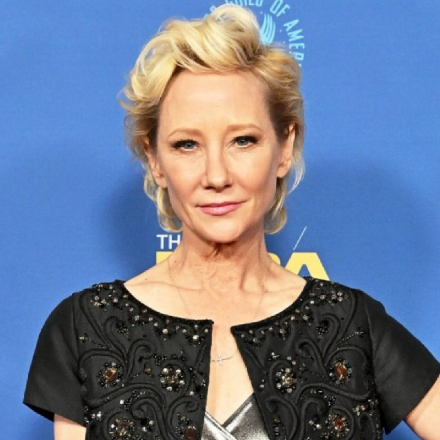 Anne Heche in critical condition following fiery car crash